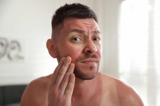 sun damage treatments