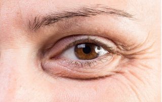thin eyebrow treatments
